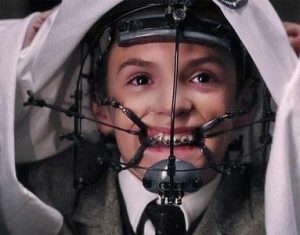 Что требуется для исправления прикуса помимо брекетов?