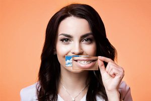 Что устанавливать сначала: имплантат или брекеты?