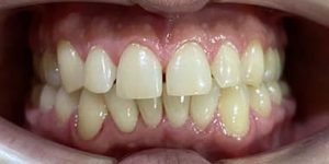 Необходимость сократить сроки лечения без потери качества.