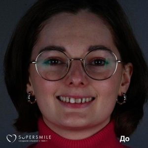 До/После №6803