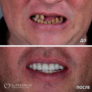 До/После №8246