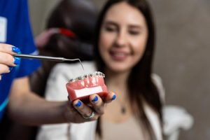 Из чего складывается стоимость лечения с помощью брекет-систем?