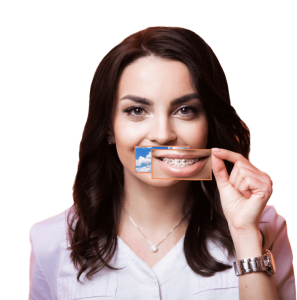 Брекет системы под ключ