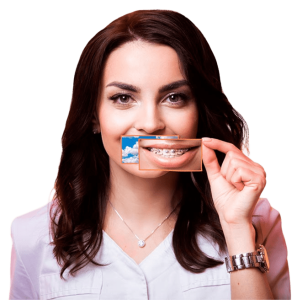 Исправление прикуса