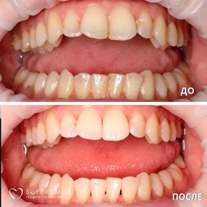 До/После №8402