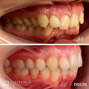 До/После №7347