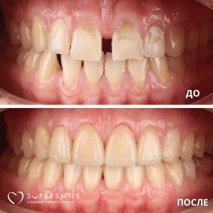 До/После №7460