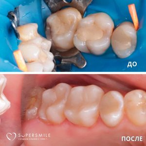 До/После №7903