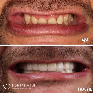 До/После №16197