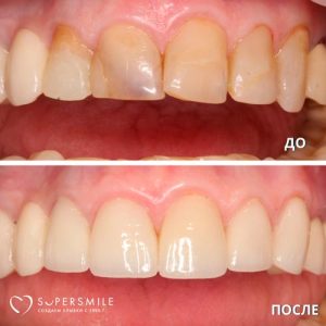 До/После №6797