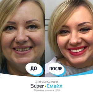 До/После №8391