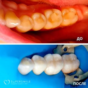 До/После №7935