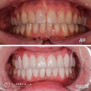 До/После №6795