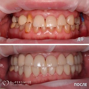 До/После №7469