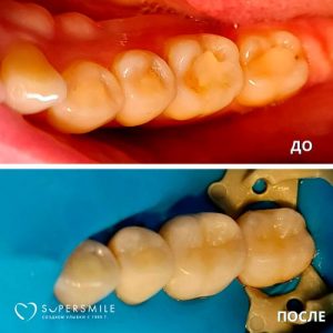 До/После №6432