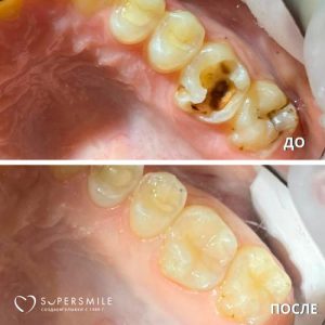 До/После №6431