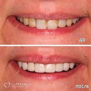 До/После №7467