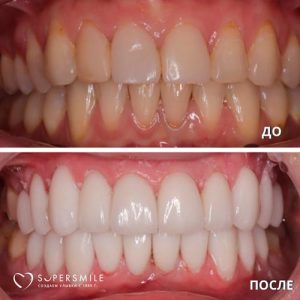 До/После №6791