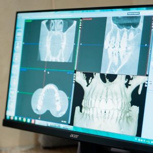 До/После №7584