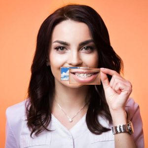 Этот долгожданный момент. Как снимают брекеты?