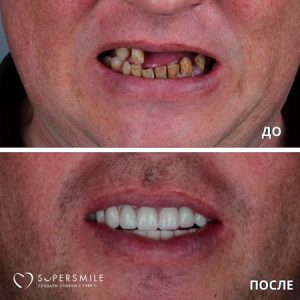 Кейсы: реальные примеры решения проблем с помощью системы all-on-4