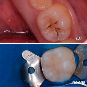 До/После №7926