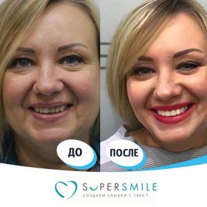 Стоматология против старения: что такое Anti-Age, сколько стоит комплекс процедур