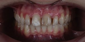 До/После №5457