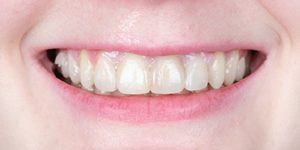 До/После №5458