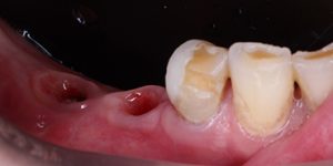 До/После №5459