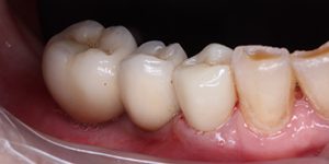 До/После №5460