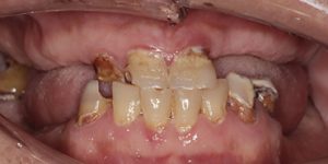 До/После №5461