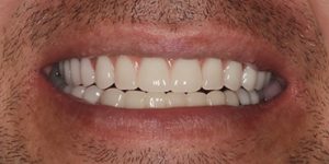 До/После №5462