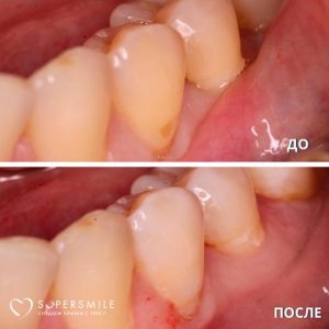 До/После №6441