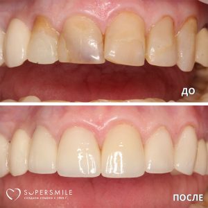 До/После №7785