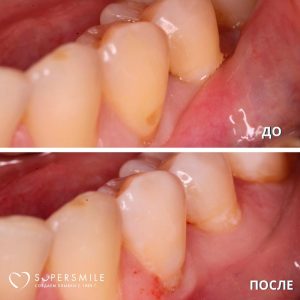 До/После №7927