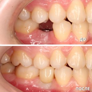 До/После №5771