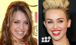 Улыбки на миллионы: брекеты и виниры Голливуда