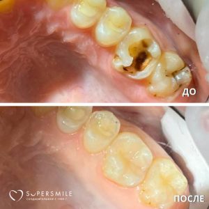 До/После №6440