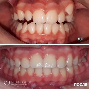 До/После №6583