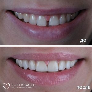 До/После №7784