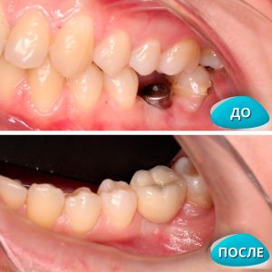 До/После №8216