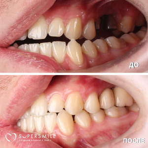 До/После №16182