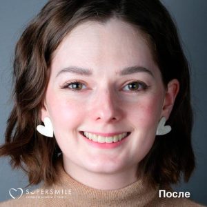 До/После №6802