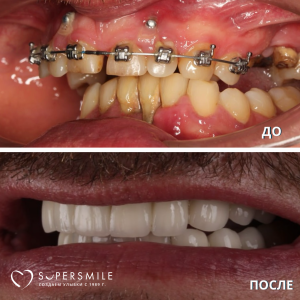 До/После №16180