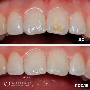 До/После №7929