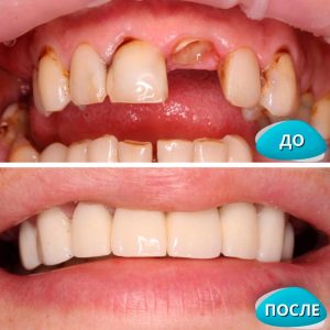 До/После №8217