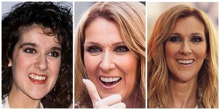 Коррекция может быть частичной, только на отдельных зубах