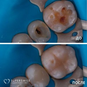 До/После №6438