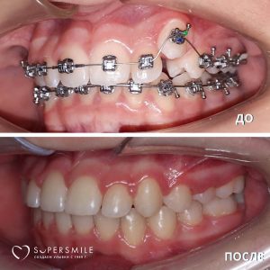 До/После №6582